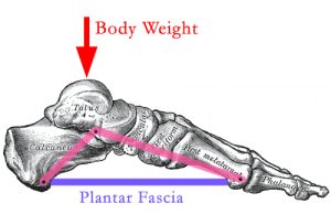 Plantar Fasciitis Body Weight